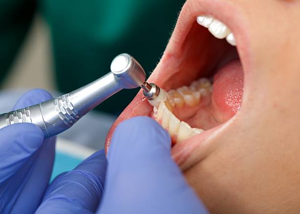 Best Root Canal Treatment  in Hoquiam, WA